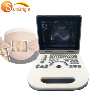 Najcenejše cene Sunbright prenosni ultrazvok 2D medicinskih ultrazvočnih stroj